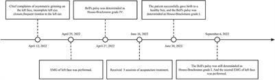 Acupuncture treatment of a pregnant patient with Bell's palsy in the third trimester: Case report